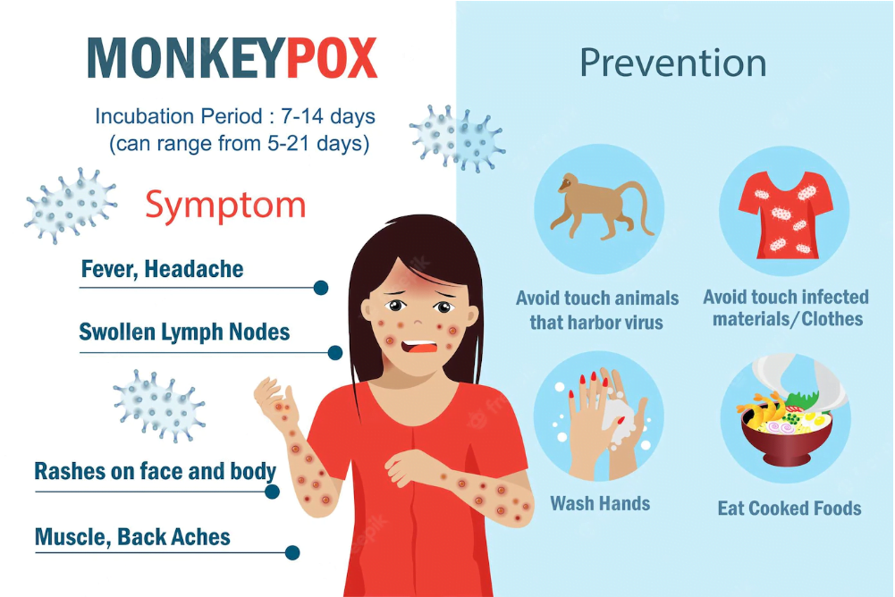 Monkeypox Disease - Symptoms and treatment