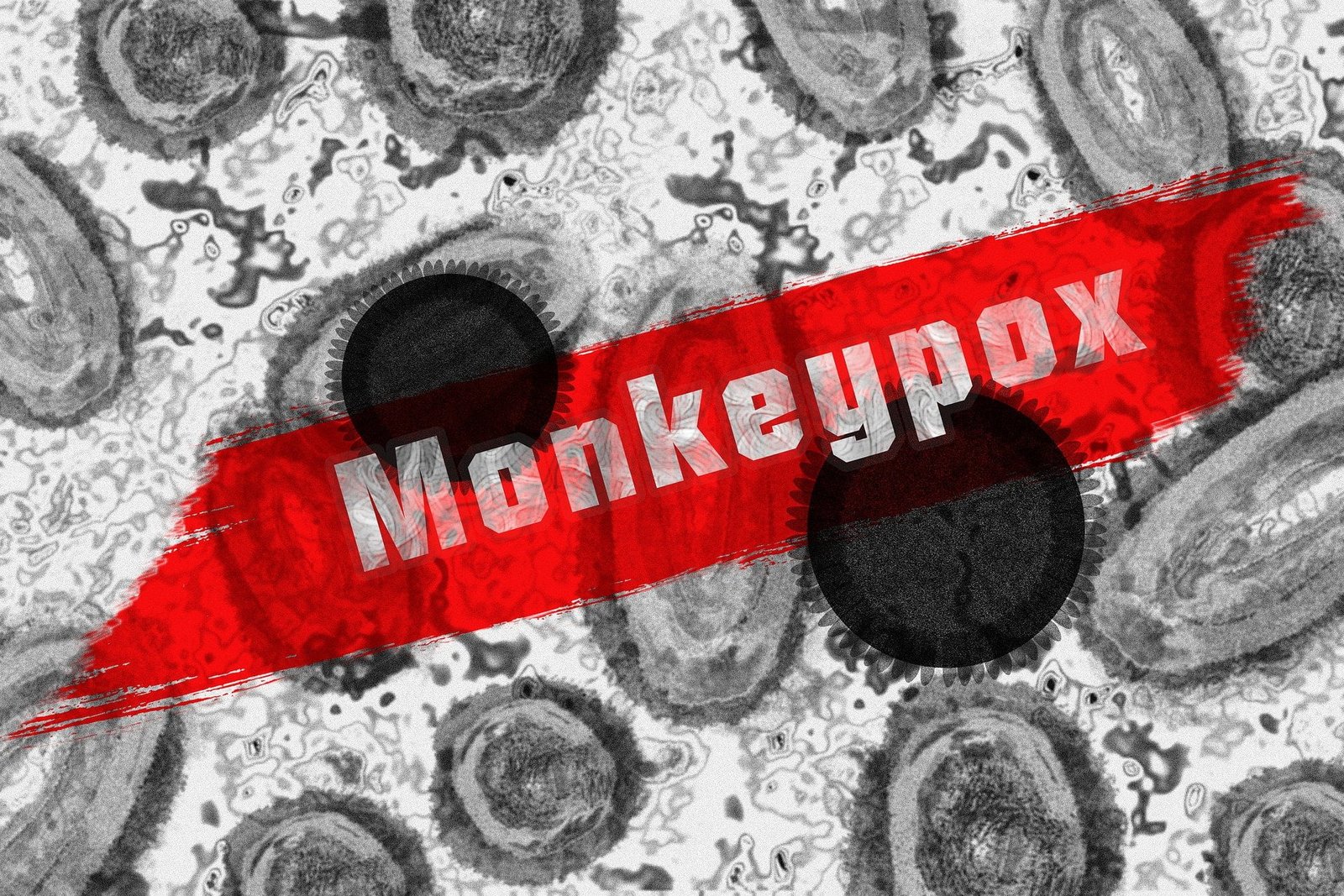 Monkeypox Disease